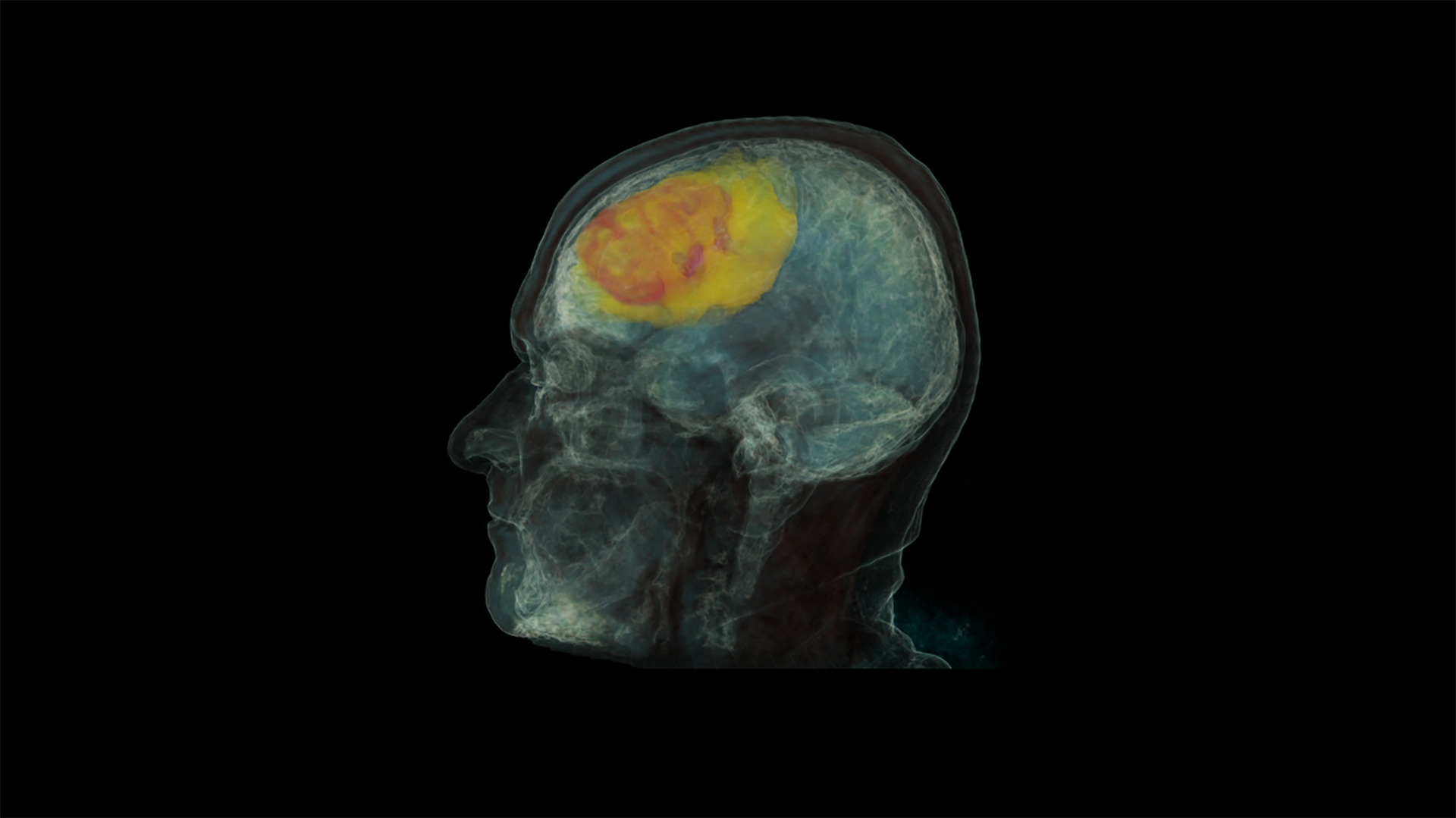 โปรเจ็กต์ imageeye brain scan